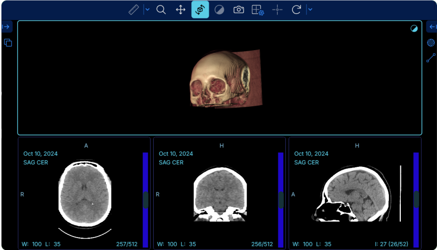 Visor Dicom